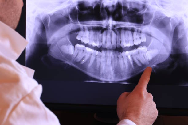 Best Emergency Broken Tooth Repair in Clintonville, WI