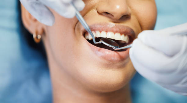 Best Emergency Tooth Extraction in Clintonville, WI